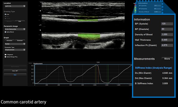 Arterial Analysis