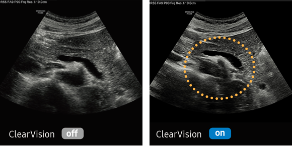 Samsung RS80 EVO ClearVision