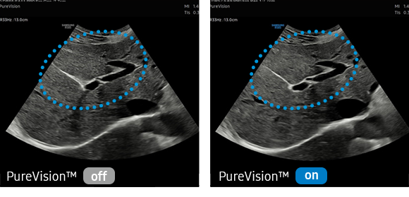 Samsung RS85 PureVision